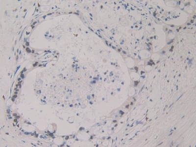 Polyclonal Antibody to Sex Hormone Binding Globulin (SHBG)