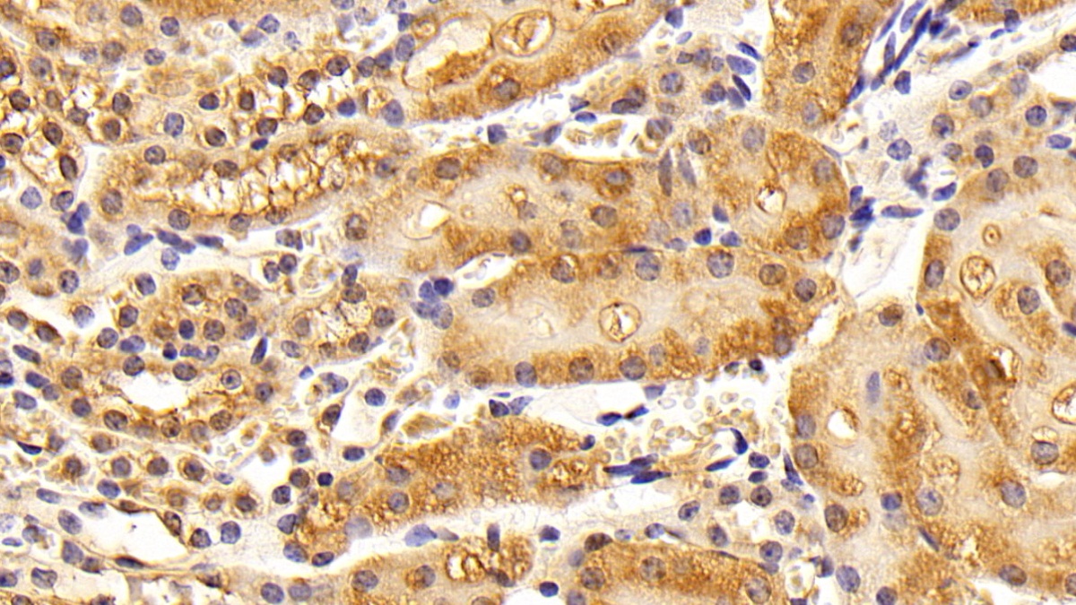 Polyclonal Antibody to Sex Hormone Binding Globulin (SHBG)