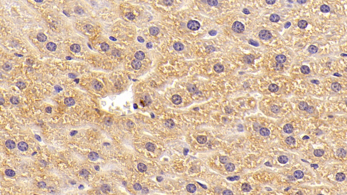 Polyclonal Antibody to Sex Hormone Binding Globulin (SHBG)