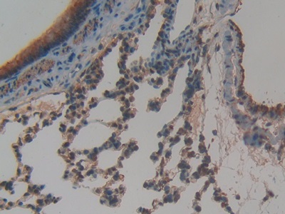 Polyclonal Antibody to Sex Hormone Binding Globulin (SHBG)