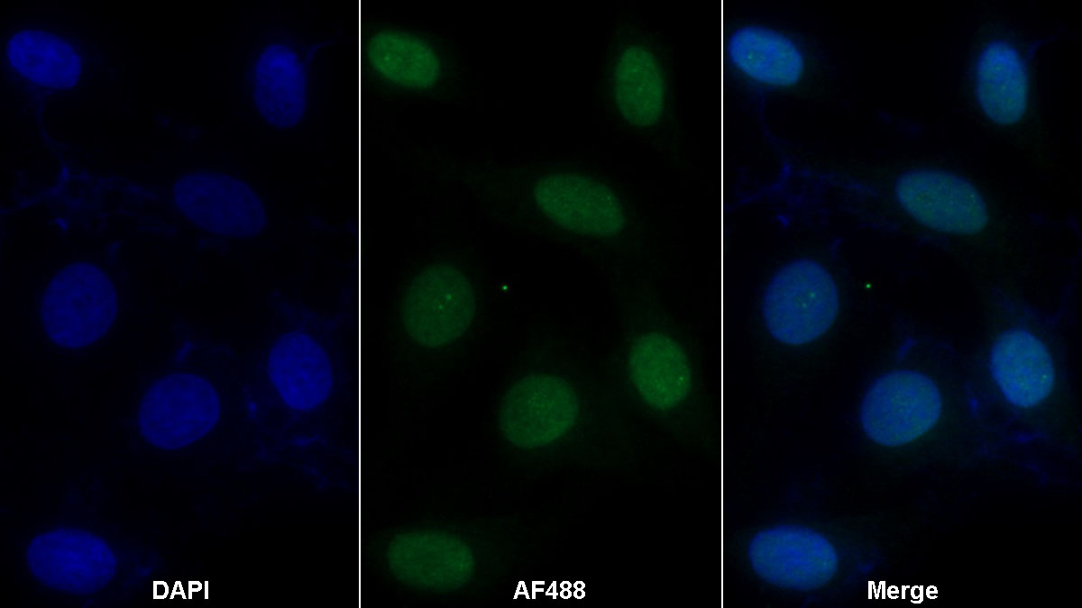 Polyclonal Antibody to High Mobility Group Protein 1 (HMGB1)