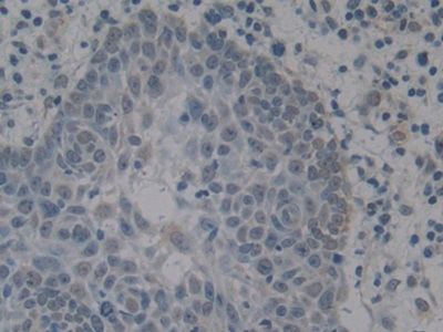 Polyclonal Antibody to High Mobility Group Protein 1 (HMGB1)