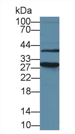 Polyclonal Antibody to High Mobility Group Protein 1 (HMGB1)