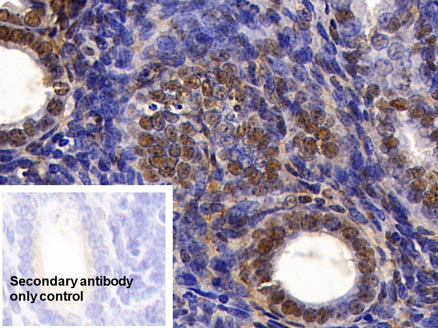 Polyclonal Antibody to High Mobility Group Protein 1 (HMGB1)