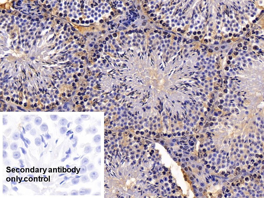 Polyclonal Antibody to High Mobility Group Protein 1 (HMGB1)