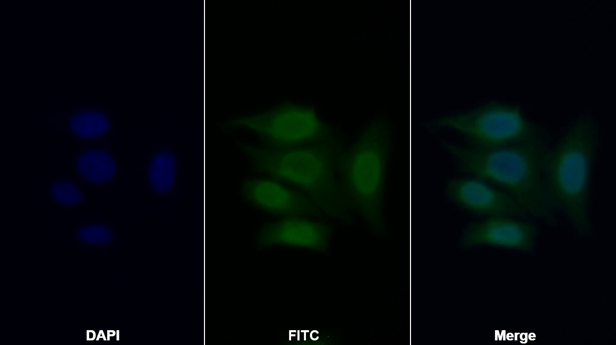 Polyclonal Antibody to High Mobility Group Protein 1 (HMGB1)