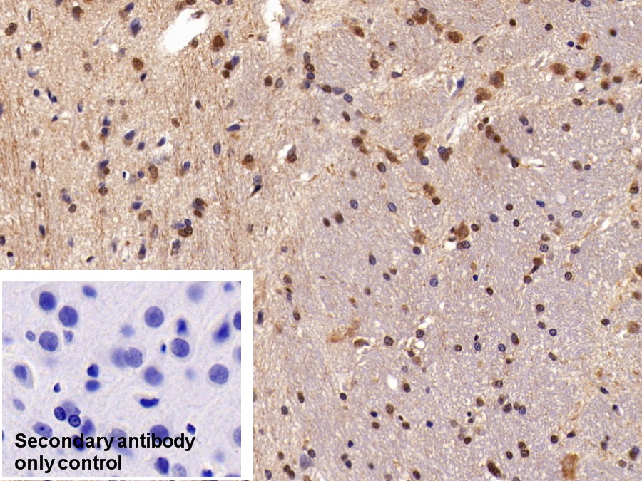 Polyclonal Antibody to High Mobility Group Protein 1 (HMGB1)