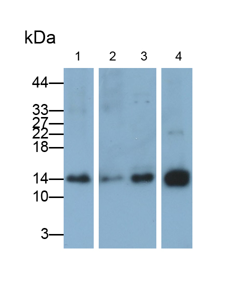 Polyclonal Antibody to Retinol Binding Protein 1, Cellular (RBP1)