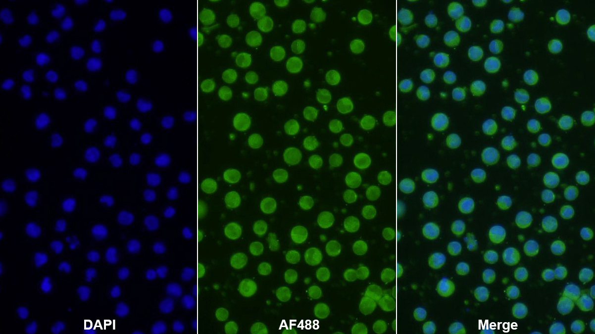 Polyclonal Antibody to Retinol Binding Protein 1, Cellular (RBP1)