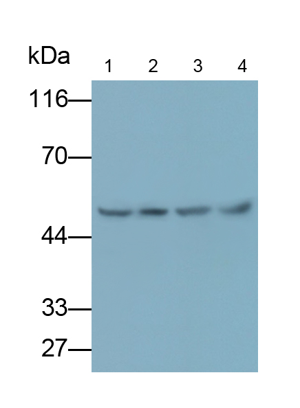 Polyclonal Antibody to Matrix Metalloproteinase 12 (MMP12)