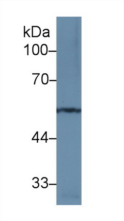 Polyclonal Antibody to Matrix Metalloproteinase 12 (MMP12)