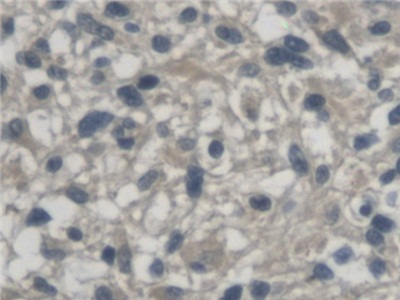 Polyclonal Antibody to Kallikrein 9 (KLK9)