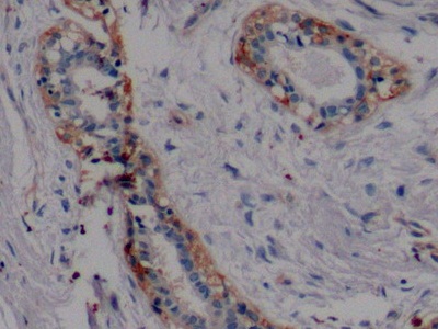 Polyclonal Antibody to Mucin 1 (MUC1)