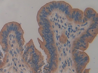 Polyclonal Antibody to Mucin 1 (MUC1)