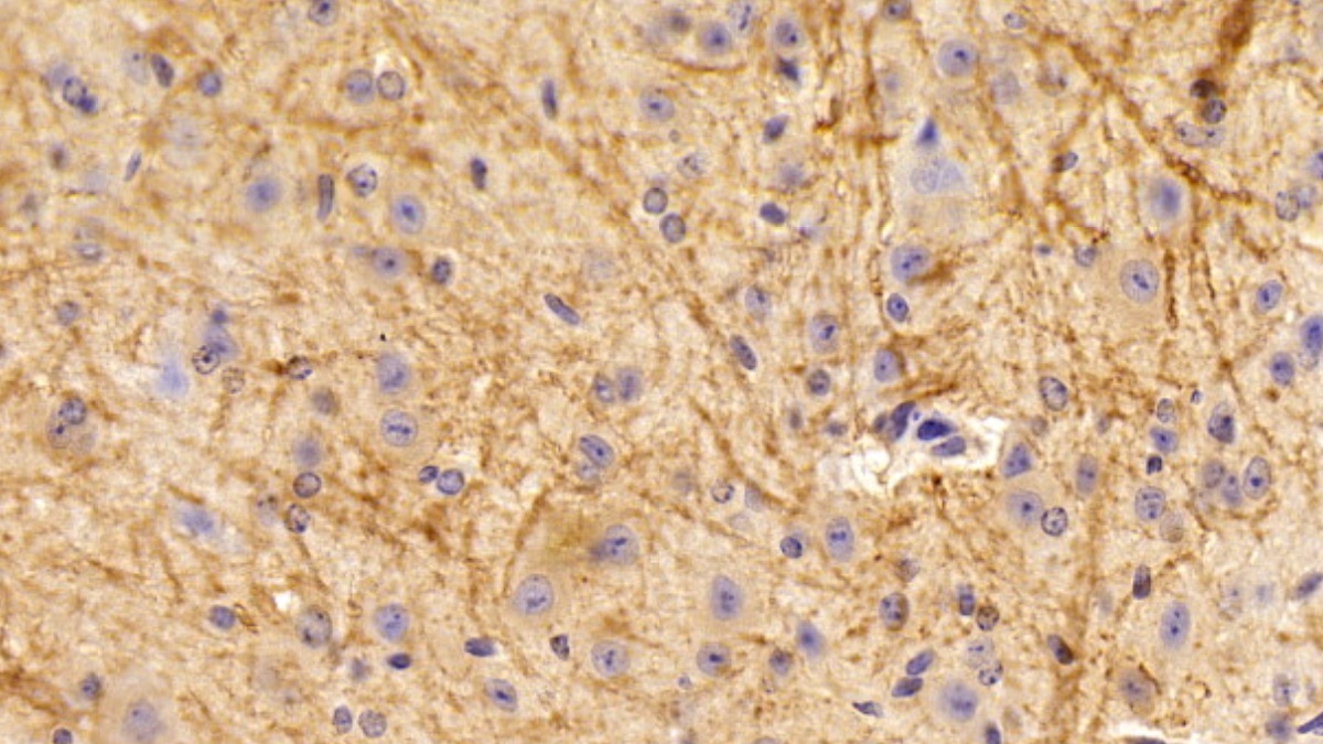 Polyclonal Antibody to Myelin Oligodendrocyte Glycoprotein (MOG)