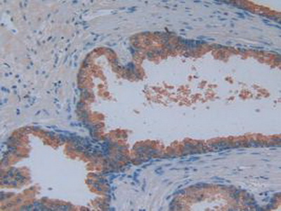 Polyclonal Antibody to Myelin Associated Glycoprotein (MAG)