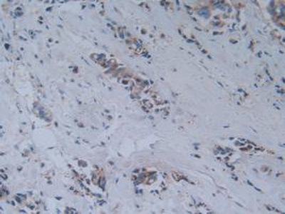 Polyclonal Antibody to Myelin Associated Glycoprotein (MAG)