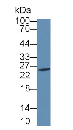 Polyclonal Antibody to Granzyme M (GZMM)