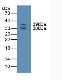 Polyclonal Antibody to Lipase, Endothelial (LIPG)