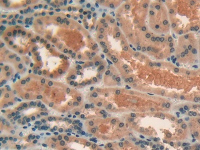 Polyclonal Antibody to Lipase, Endothelial (LIPG)