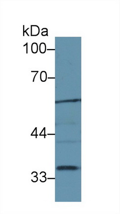 Polyclonal Antibody to Lipase, Endothelial (LIPG)