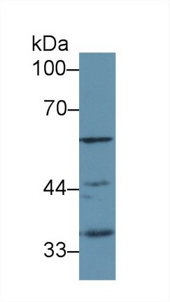 Polyclonal Antibody to Lipase, Endothelial (LIPG)