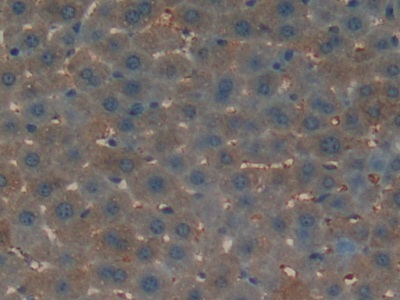 Polyclonal Antibody to Osteocalcin (OC)