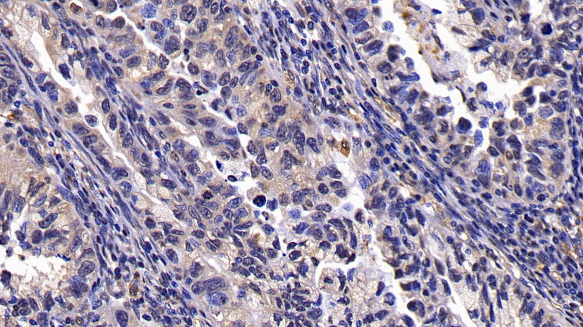 Polyclonal Antibody to Calcitonin (CT)