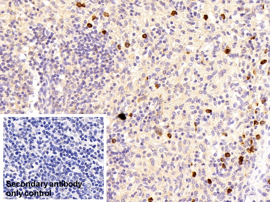 Polyclonal Antibody to Cystatin A (CSTA)