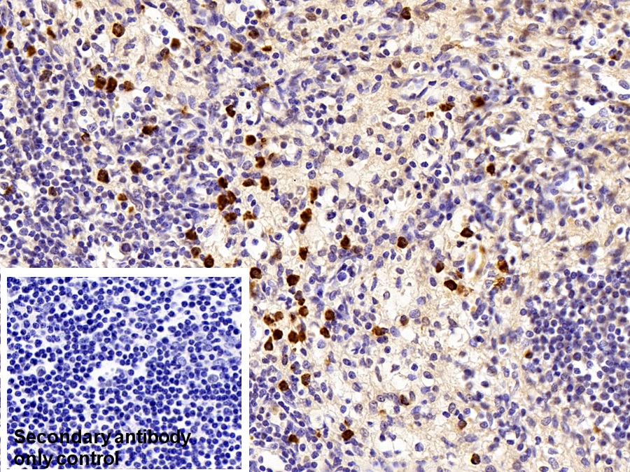 Polyclonal Antibody to Cystatin A (CSTA)