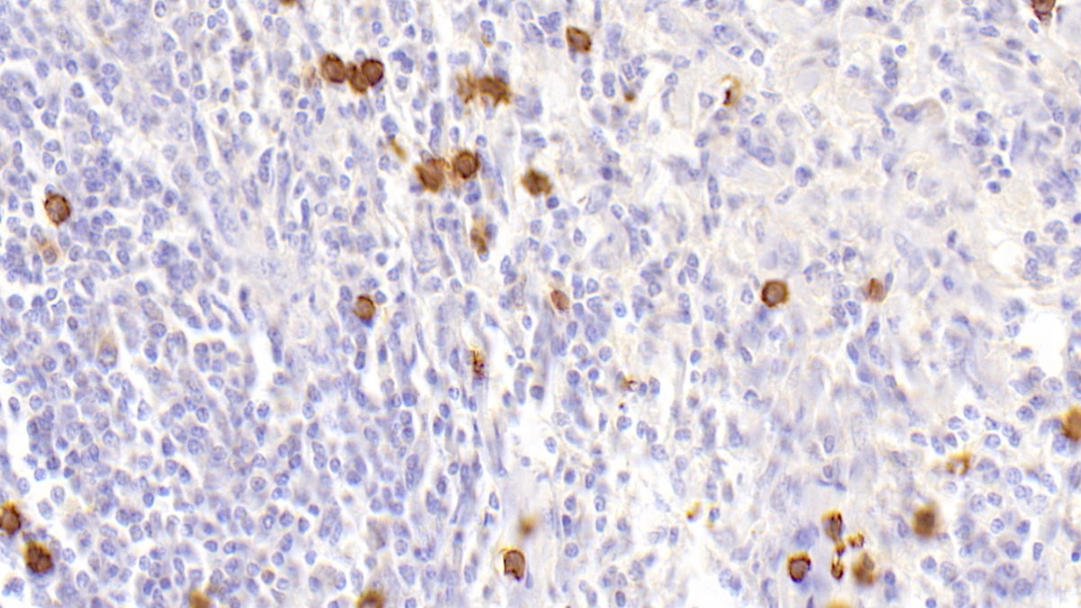 Polyclonal Antibody to Cystatin A (CSTA)