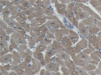 Polyclonal Antibody to Cardiac Troponin I (cTnI)