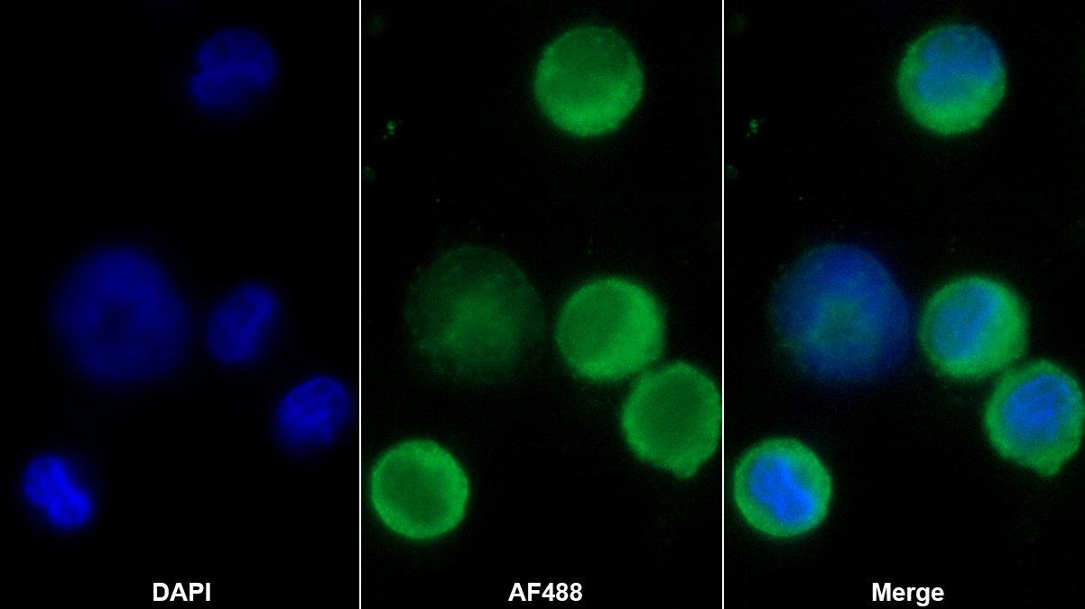 Polyclonal Antibody to Cardiac Troponin I (cTnI)