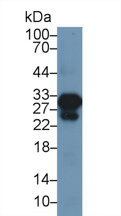 Polyclonal Antibody to Cardiac Troponin I (cTnI)