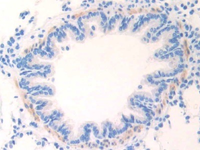 Polyclonal Antibody to Cardiac Troponin I (cTnI)