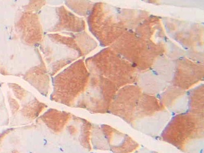 Polyclonal Antibody to Cardiac Troponin I (cTnI)