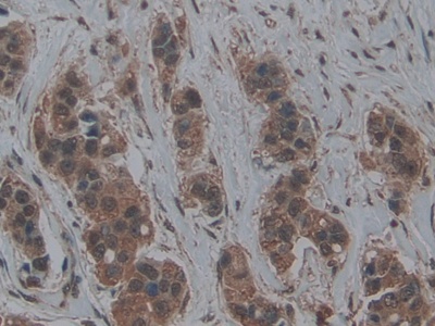 Polyclonal Antibody to Lymphotoxin Beta Receptor (LTbR)