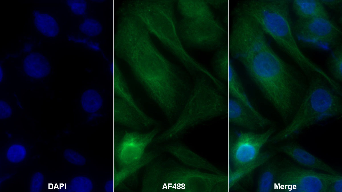 Polyclonal Antibody to Lymphotoxin Beta Receptor (LTbR)