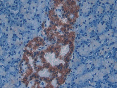 Polyclonal Antibody to Endothelin 1 (EDN1)