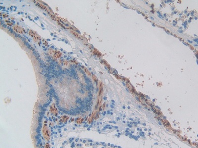 Polyclonal Antibody to Endothelin 1 (EDN1)