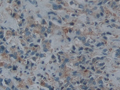 Polyclonal Antibody to Endothelin Converting Enzyme 1 (ECE1)