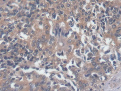 Polyclonal Antibody to N-Terminal Pro-Brain Natriuretic Peptide (NT-ProBNP)