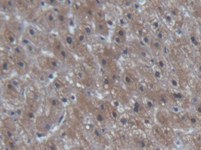 Polyclonal Antibody to N-Terminal Pro-Brain Natriuretic Peptide (NT-ProBNP)