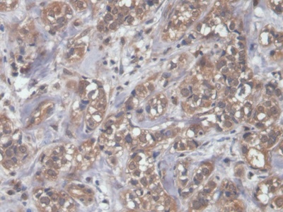 Polyclonal Antibody to N-Terminal Pro-Brain Natriuretic Peptide (NT-ProBNP)