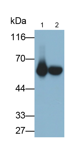 Polyclonal Antibody to Cytokeratin 5 (CK5)