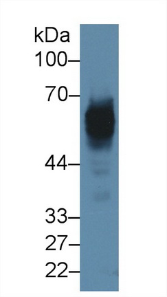 Polyclonal Antibody to Cytokeratin 5 (CK5)