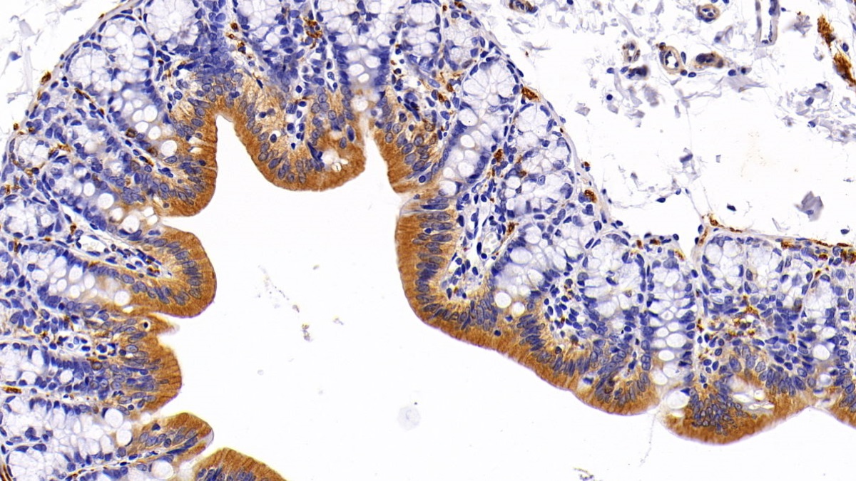 Polyclonal Antibody to Cytokeratin 5 (CK5)