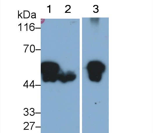 Polyclonal Antibody to Cytokeratin 5 (CK5)