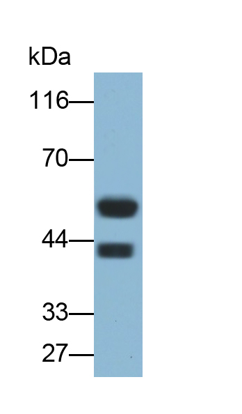 Polyclonal Antibody to Cytokeratin 5 (CK5)