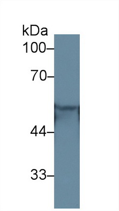 Polyclonal Antibody to Cytokeratin 4 (CK4)